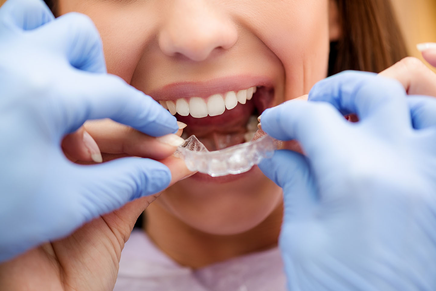 Ortodontinis gydymas